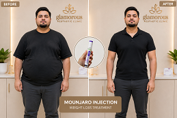 Mounjaro Before & After Lahore Pakistan