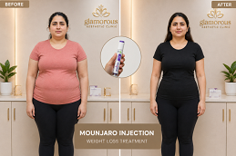 Mounjaro Before & After in Lahore Pakistan