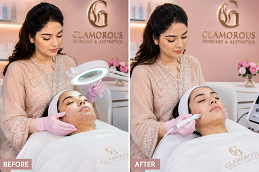 Skincare Before & After in Islamabad