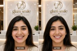 Dental Braces Before & After Clinic In Islamabad