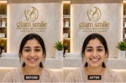 Alignar Treatment before & After Pakistan