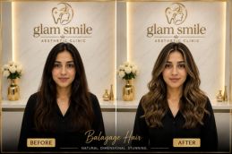 Balayage Hair Before And After In Pakistan