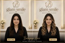 Balayage Hair Before And After Islamabad