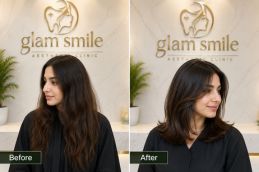 Before & After Hair CuttingClinic In Islamabad