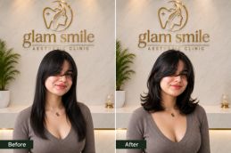 Before & After Hair CuttingClinic In Pakistan