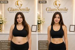 Before & After of mounjaro injection in Islamabad