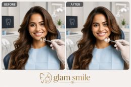 Before And After Dental Filling Clinic In Islamabad