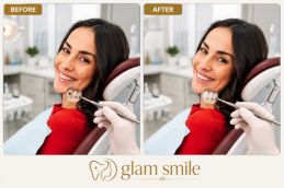 Before And After Dental Filling In Islamabad