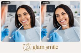Before And After Dental Filling In Pakistan