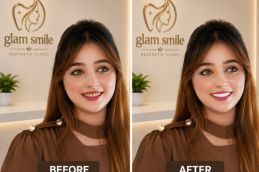 Before And After Smile Makeover Clinic In Islamabad