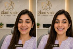 Before And After teeth removal in Islamabad (2)