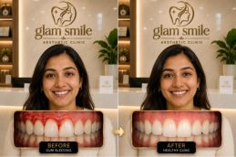Gum Bleeding Before And After clinic in pakistan