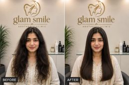 Hair Botox Before & After Clinic In Islamabad