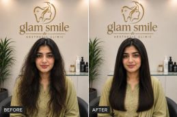 Hair botox Before & After In Pakistan (1)