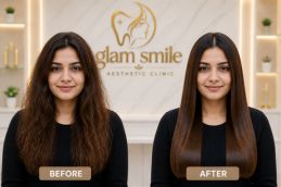 Karatin Treatment Before And After In Islamabad