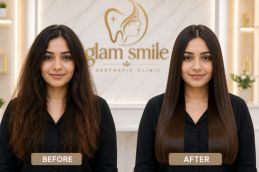 Karatin Treatment Before And After Pakistan
