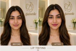 _Lip Tinting Before & After In Islamabad