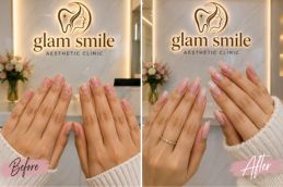 Nail Extention Before And After In Pakistan