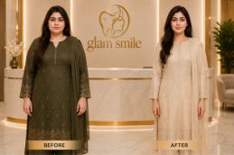 Ozempic Injections Before & After Clinic Islamabad
