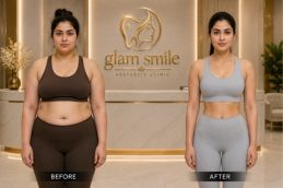 Ozempic Injections Before & After In Islamabad