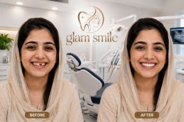 Result Of Dental Apliances In Pakistan