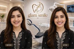 Result Of Dental Appliances Clinic Islamabad
