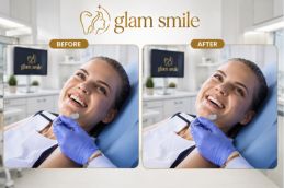 Result Of Dental Filling In Pakistan