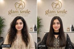 Result Of Hair Botox In Islamabad