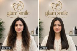 Result Of Hair Botox In Pakistan