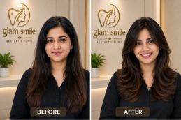 Result Of Hair Cutting Clinic In Islamabad