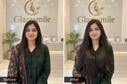 Result Of Hair Extension In Pakistan