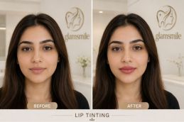 Result Of Lip Tinting In Islamabad