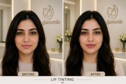 Result Of Lip Tinting In clinic Islamabad