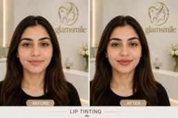 Result Of Lip Tinting In pakistan