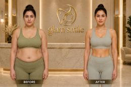 Result Of Ozempic Injections Clinic Islamabad