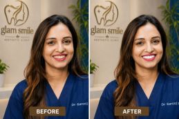 Result Of Smile Makeover Clinic In Islamabad