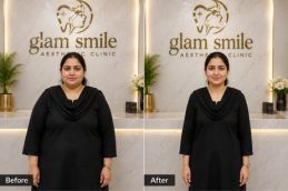 Result Of Wegovy Injection In Islamabad