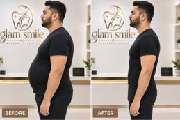 Result Of Wegovy Injection clinicbefore and after in pakistan