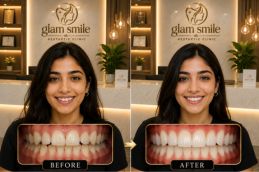 Result of Alignar Treatment In Pakistan