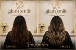 Result of Balayage Hair In Islamabad