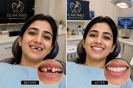 Dental Implant Before & After Clinic Islamabad
