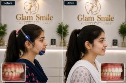 headgear Treatment Clinic in pakistan