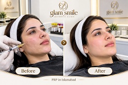 Result OF PRP in Islamabad