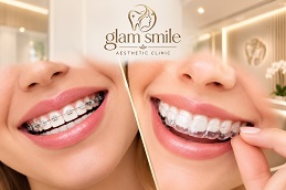 Results OF Orthodontists Islamabad