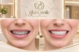 Results OF Orthodontists Pakistan