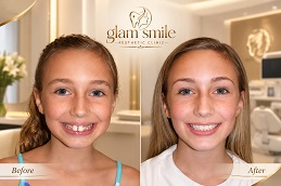Results OF Orthodontists in Islamabad